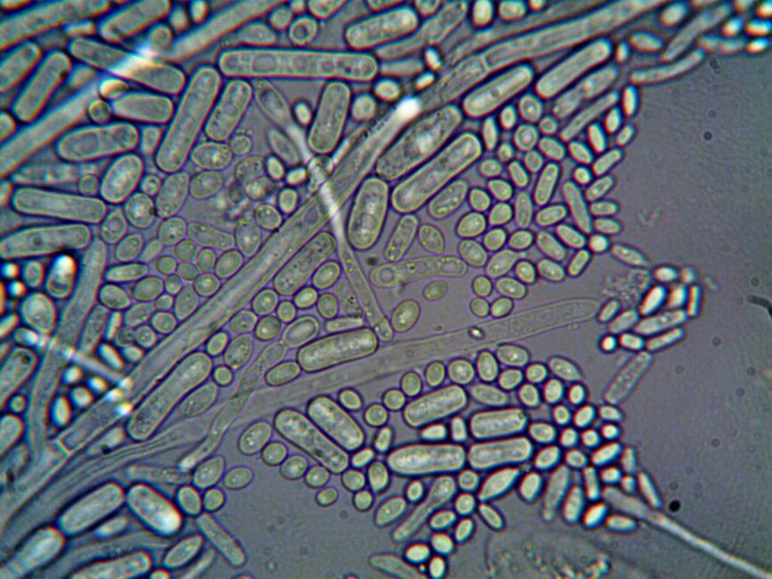 Picture for The protein that connects your stressed gut to your struggling mind