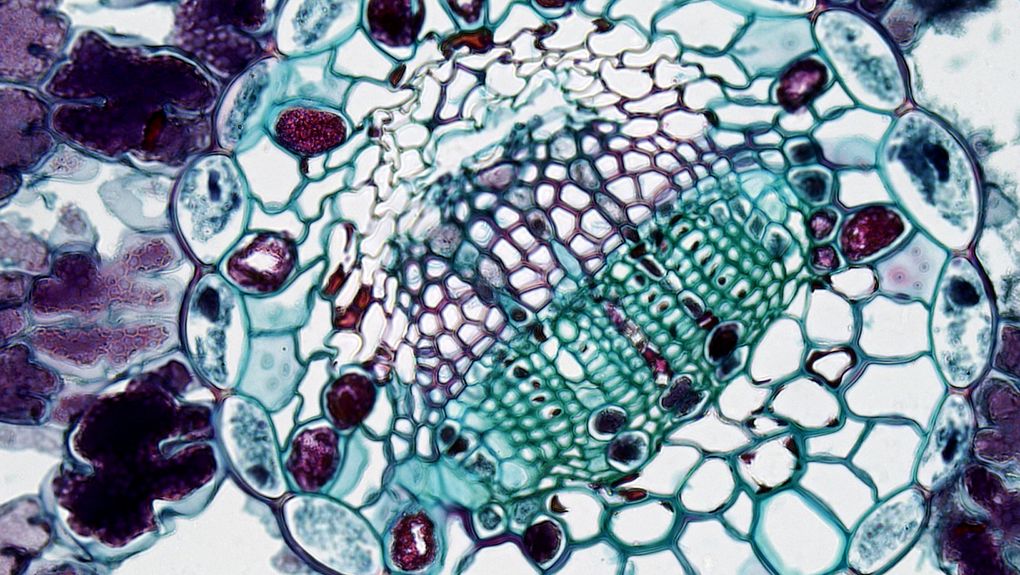 microglia cells brain tissue