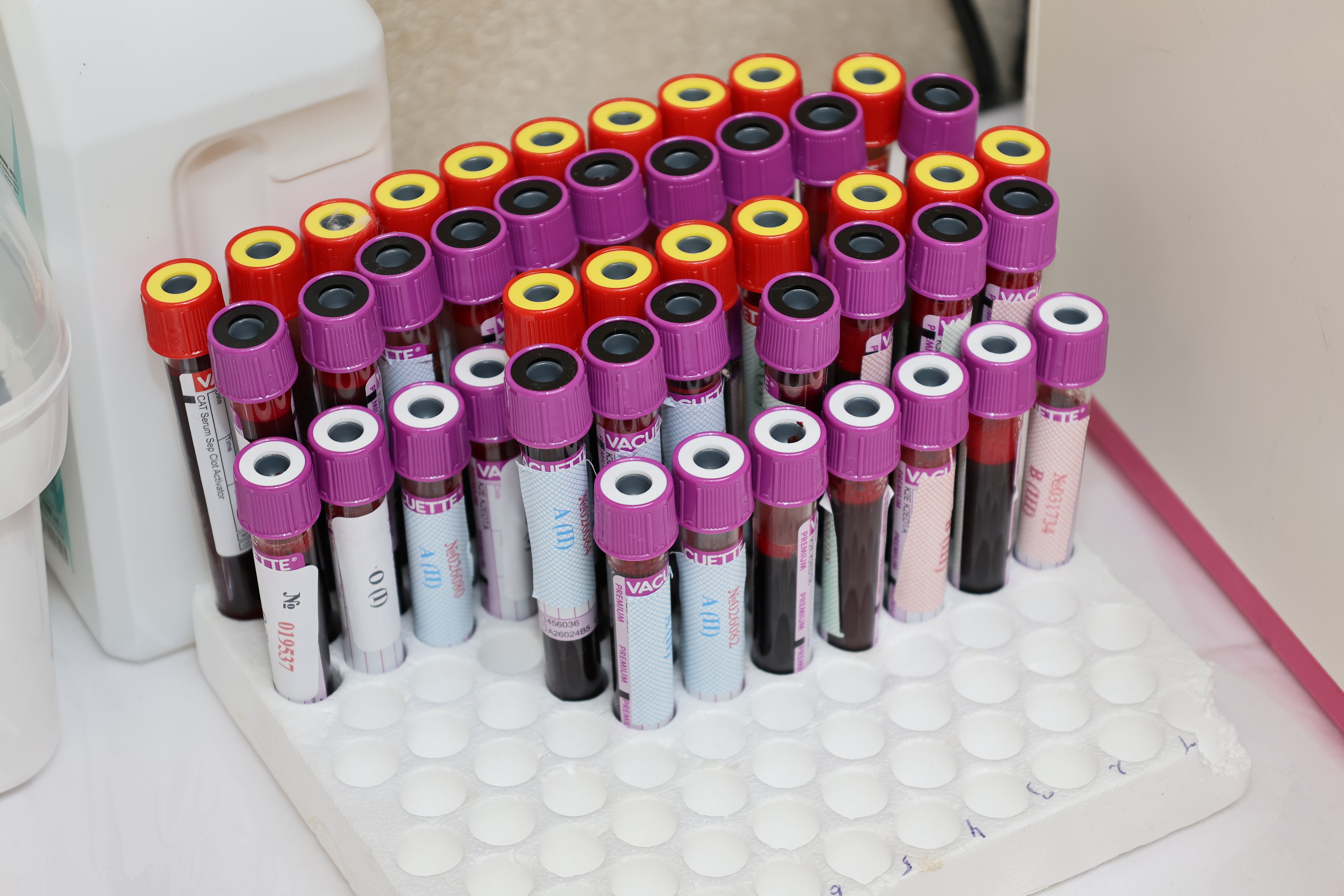 blood test vials and paperwork