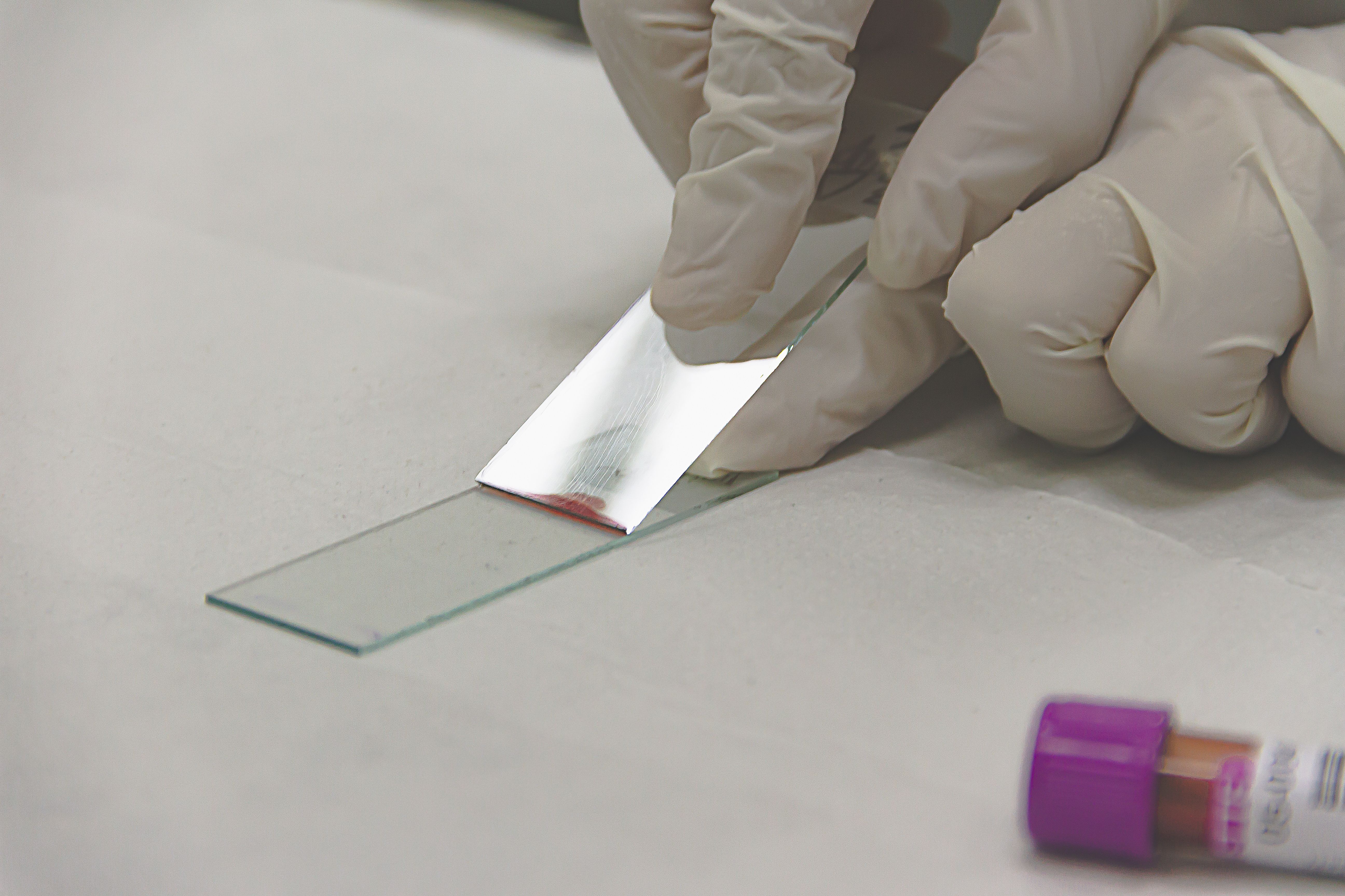 researcher examining blood sample