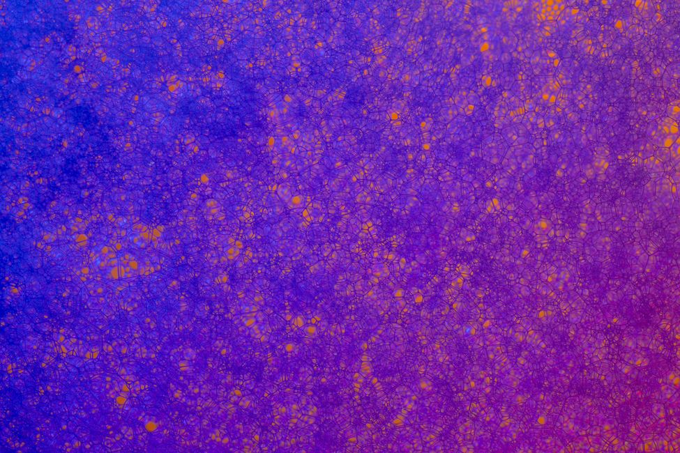 Picture for A puzzle of resilience: why some brains stay sharp despite Alzheimer's pathology