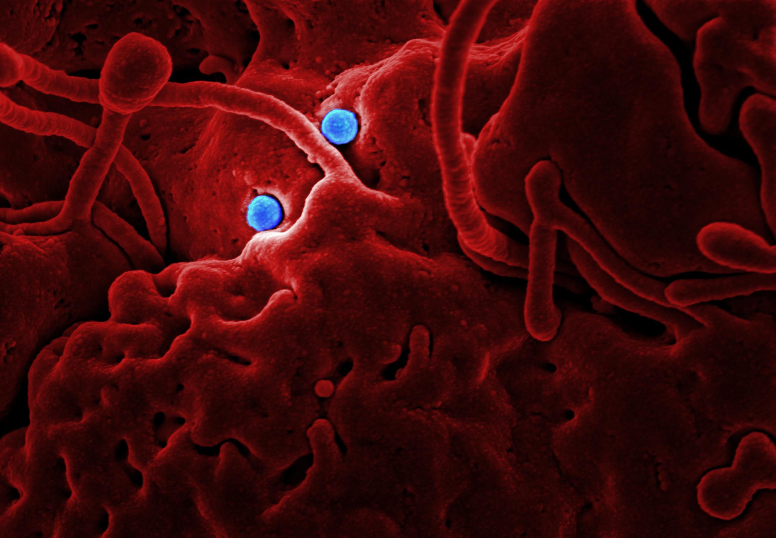 immune cells attacking tumour
