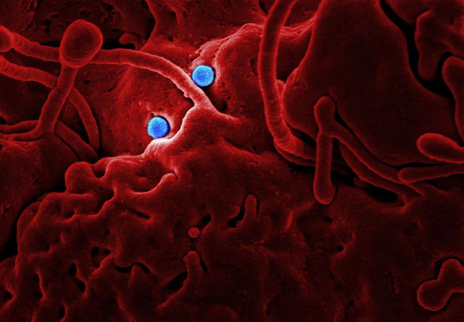 immune cells attacking tumour