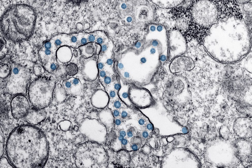 microscope immune cells view
