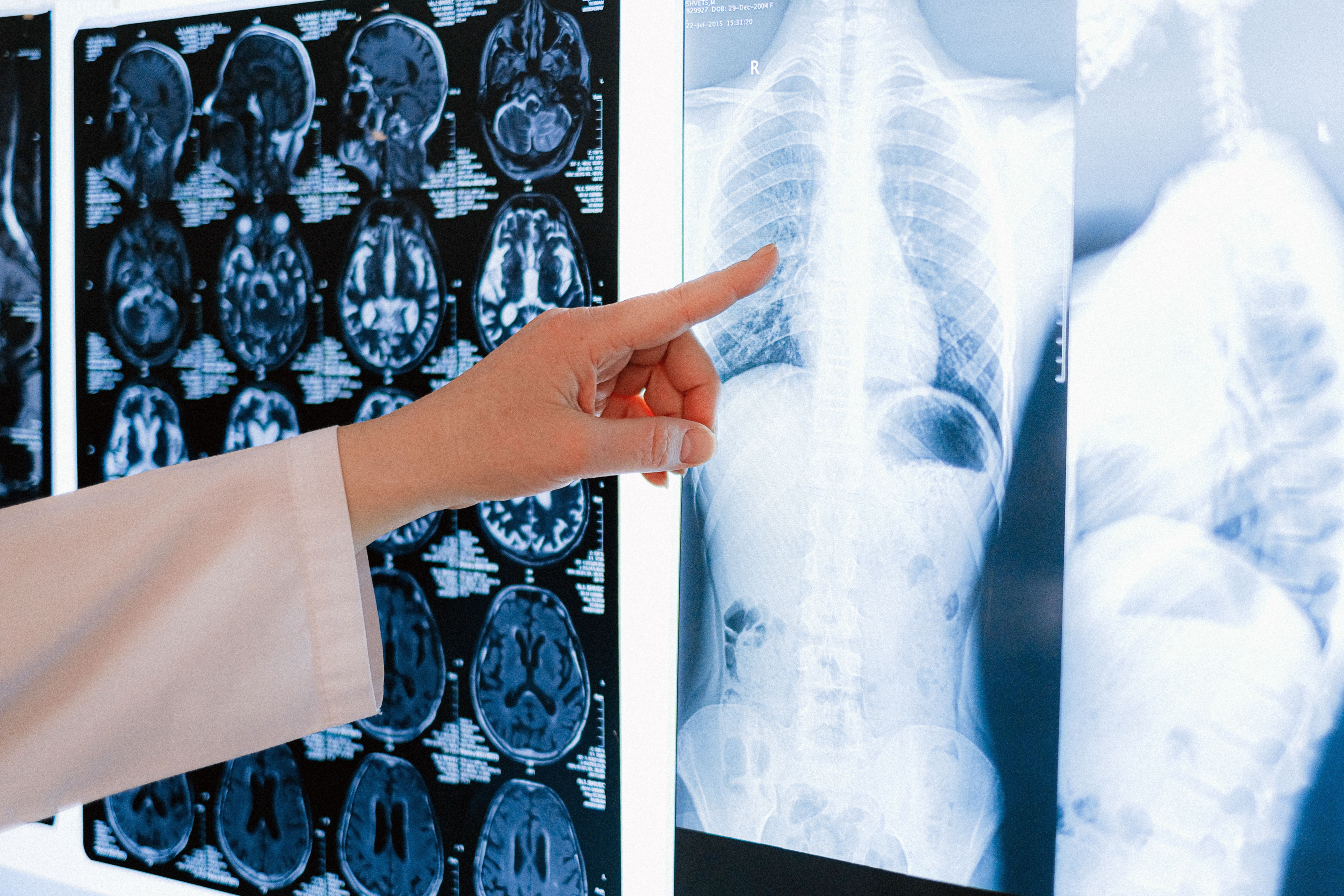 researcher examining brain scan