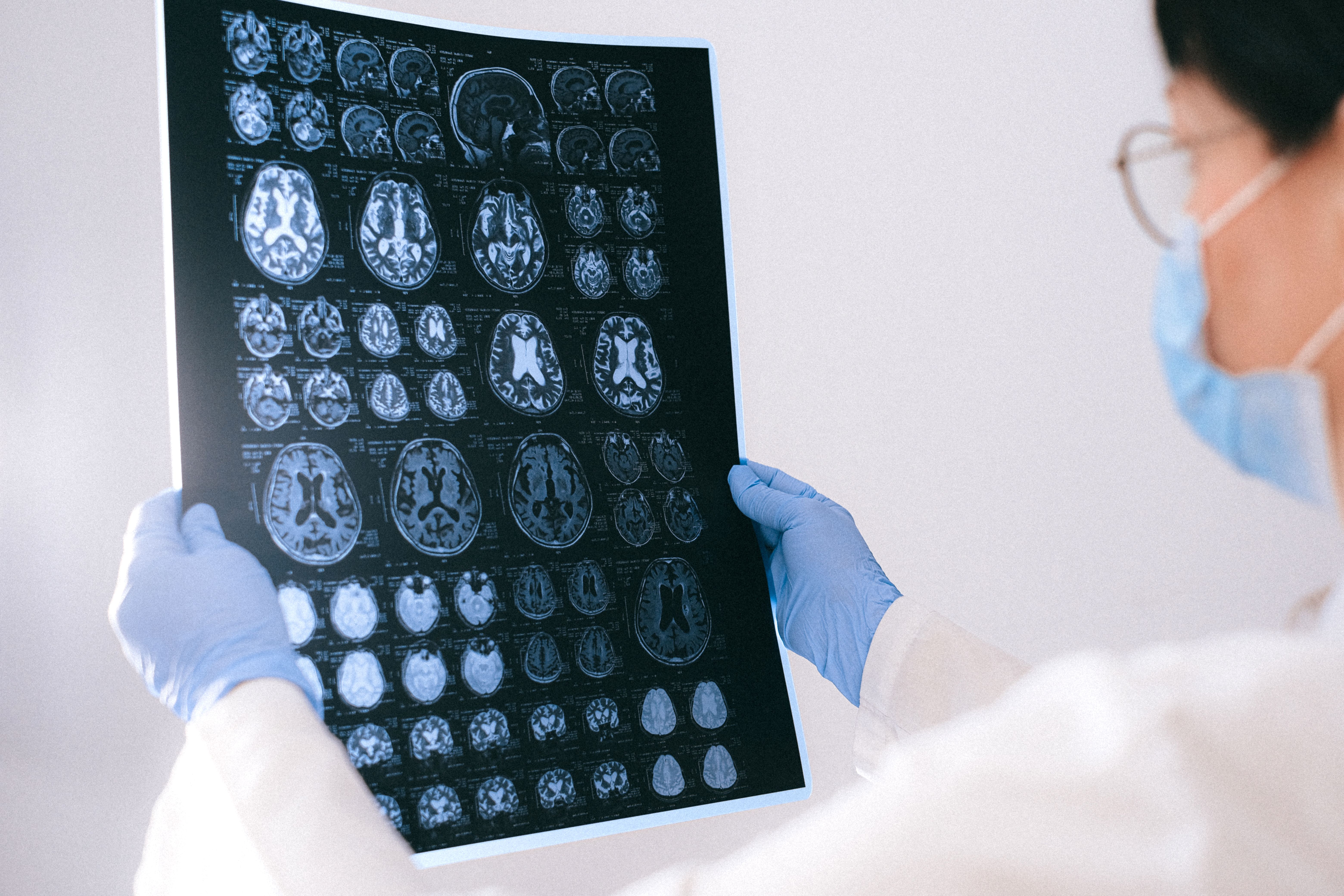 researcher reviewing brain scans