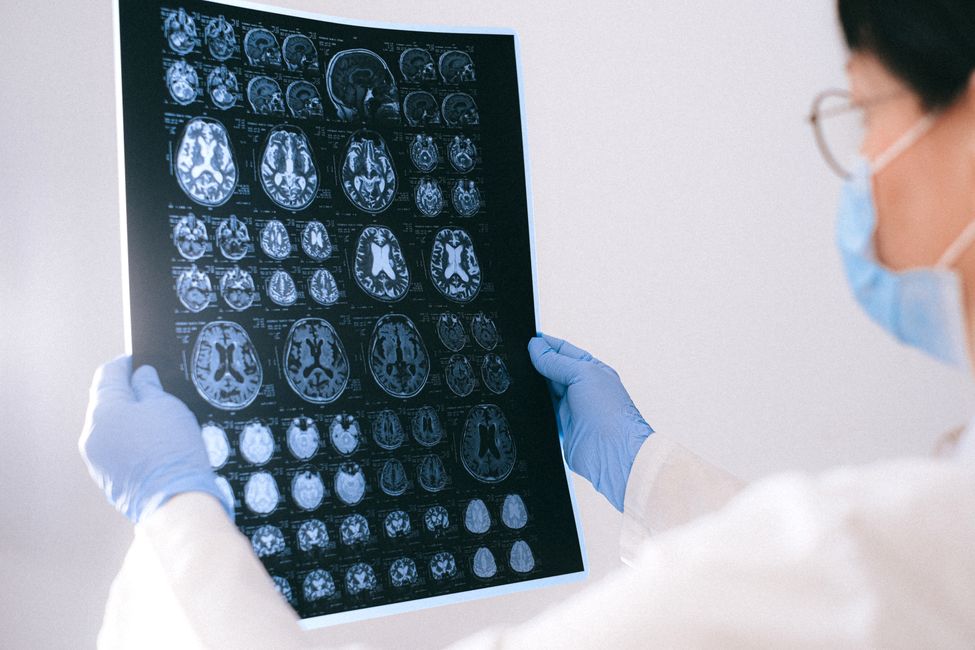 researcher reviewing brain scans