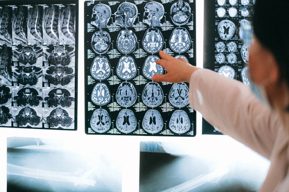 Picture for Researchers explore how brain stimulation helps people with Parkinson's walk again