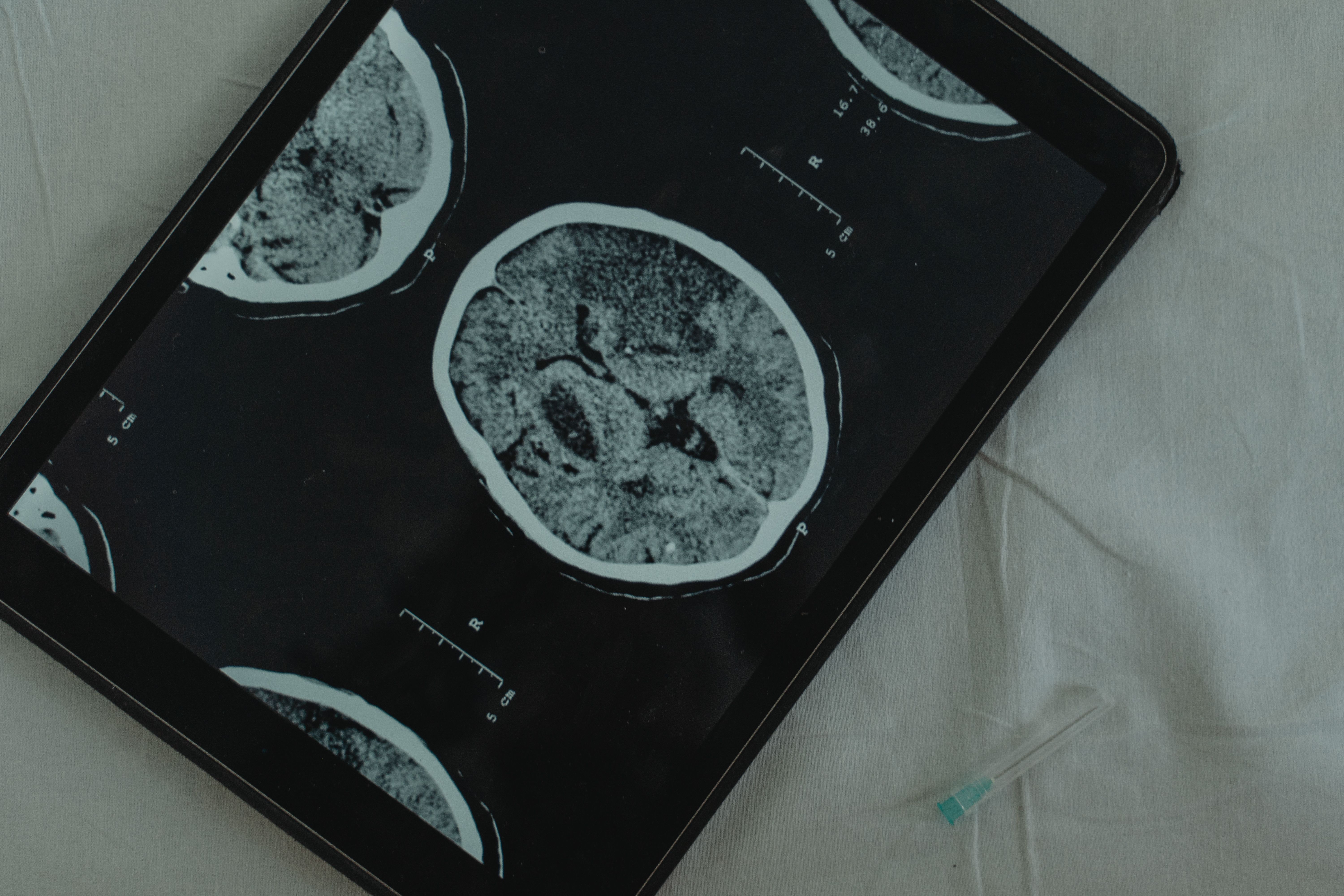 Neuroscience brain imaging scan