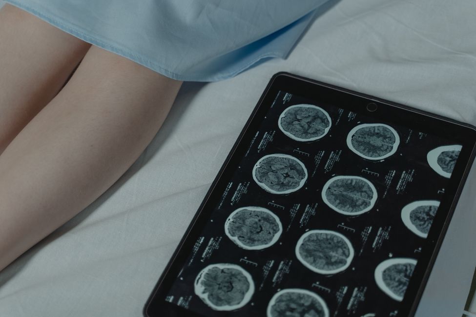 brain scan with soft light
