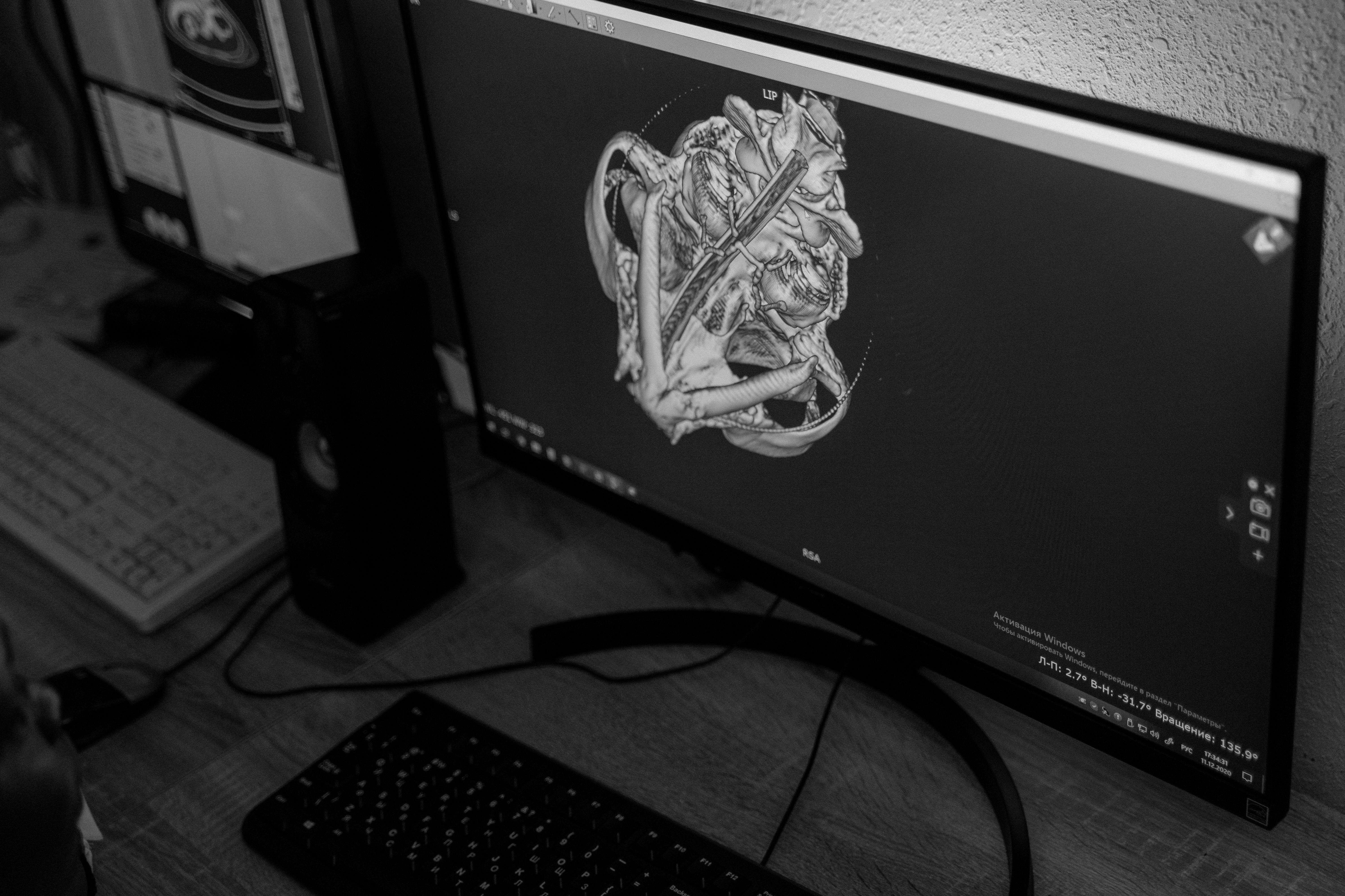 Brain scan medical imaging display