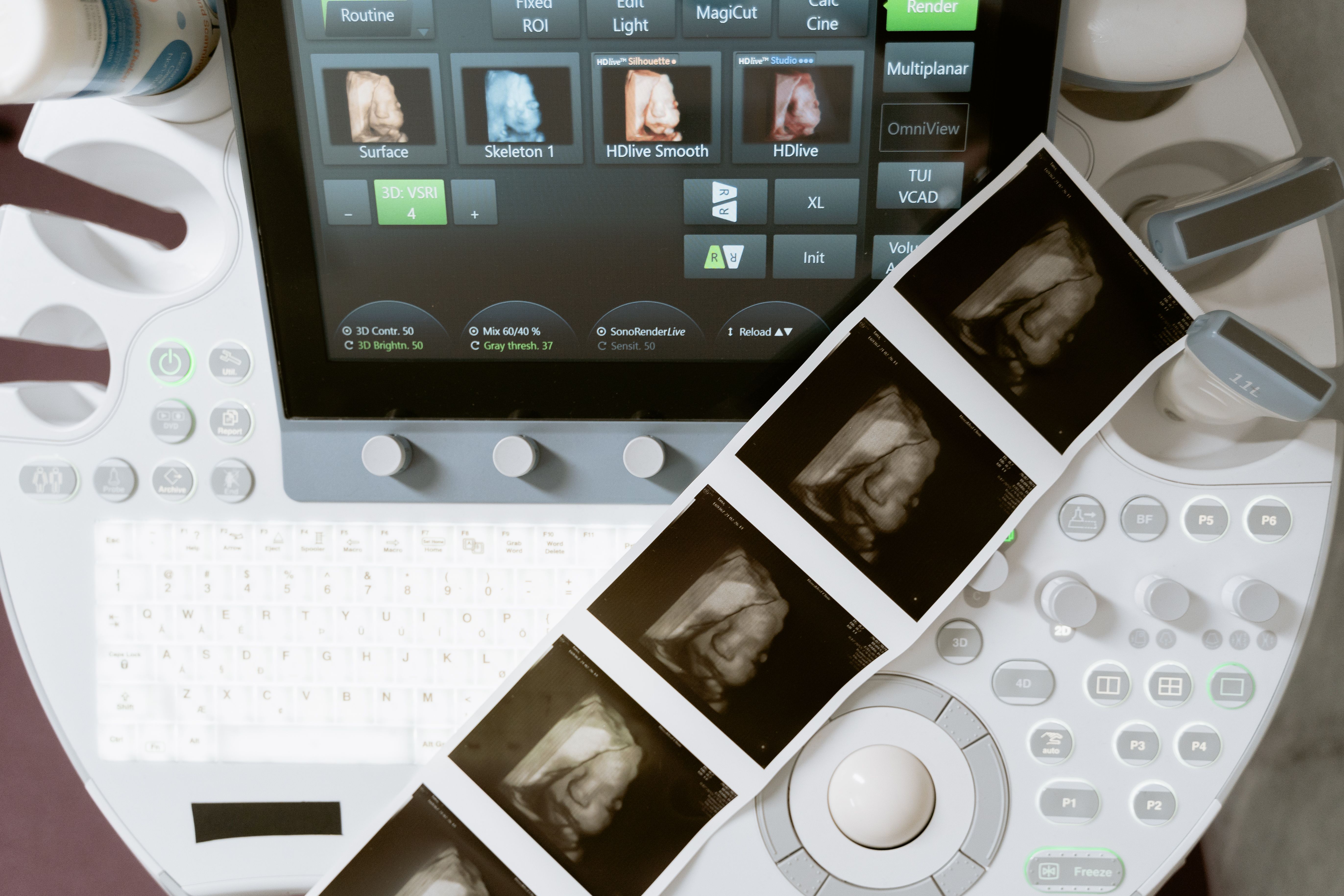 brain scan imaging technology