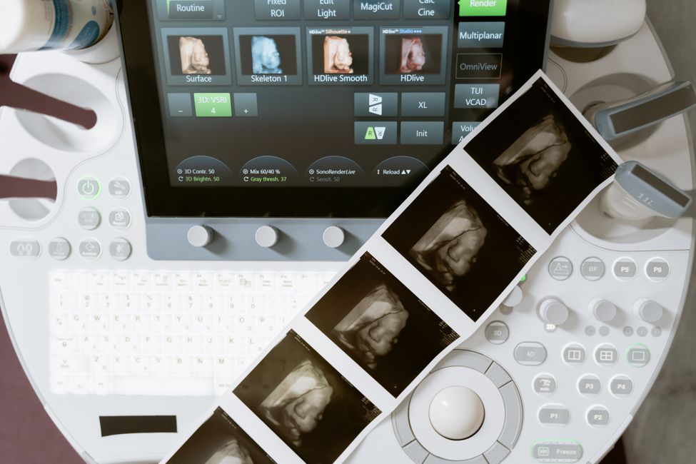 brain scan imaging technology
