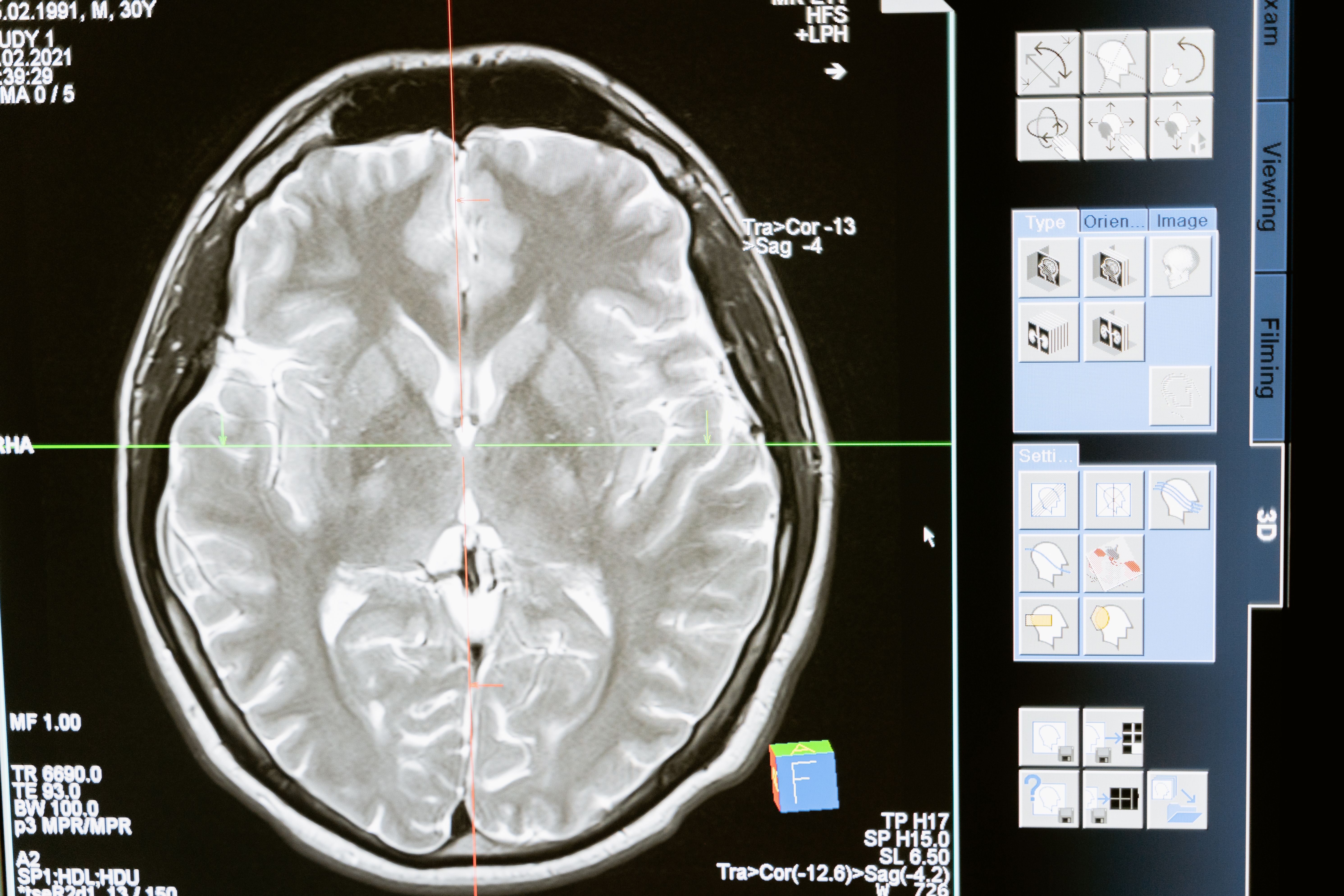 Brain scan or neural pathways