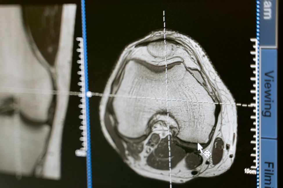 brain scan imaging display