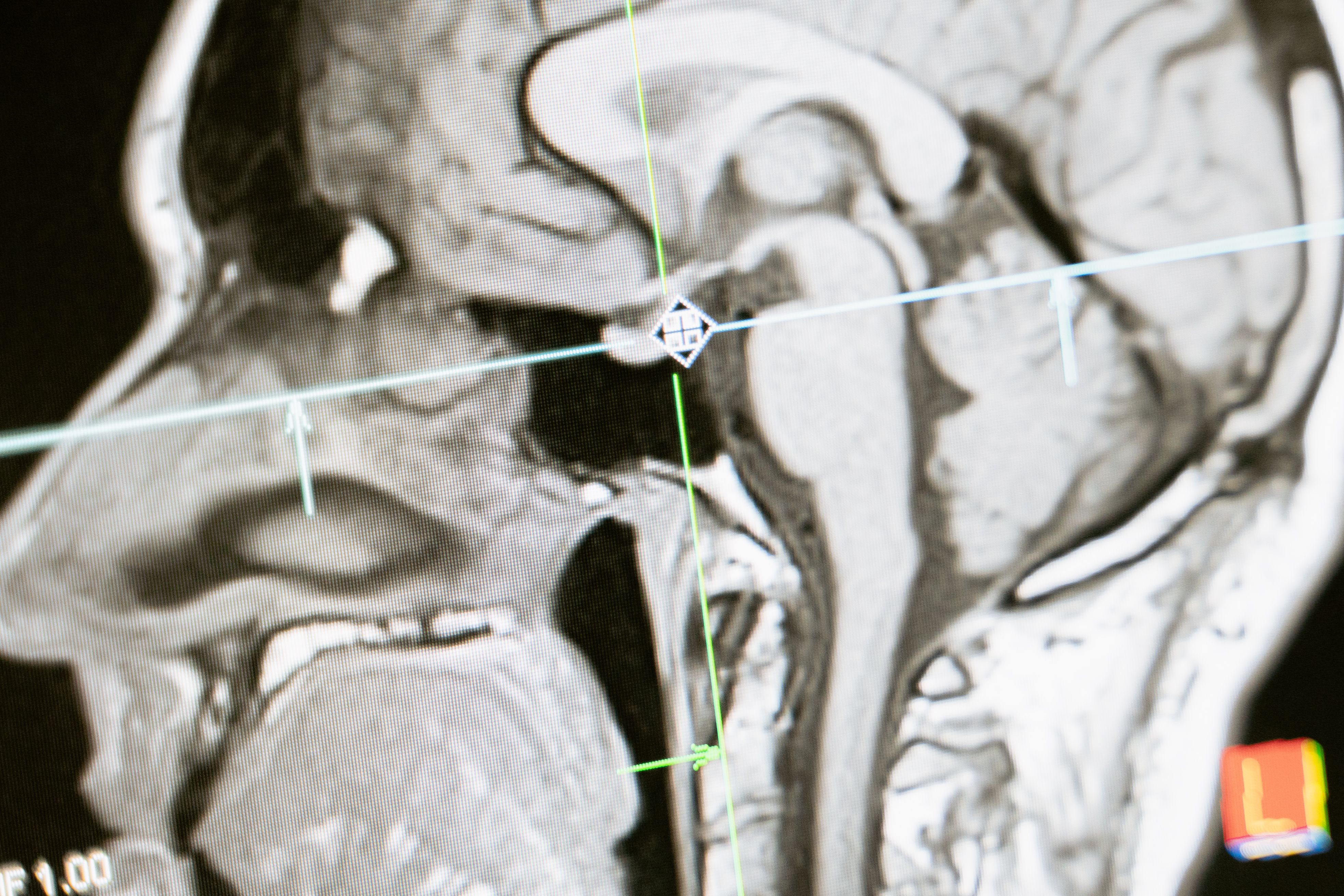 human brain cross section