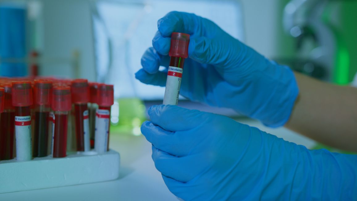 Picture for Scientists explore blood test that could identify depression risk early