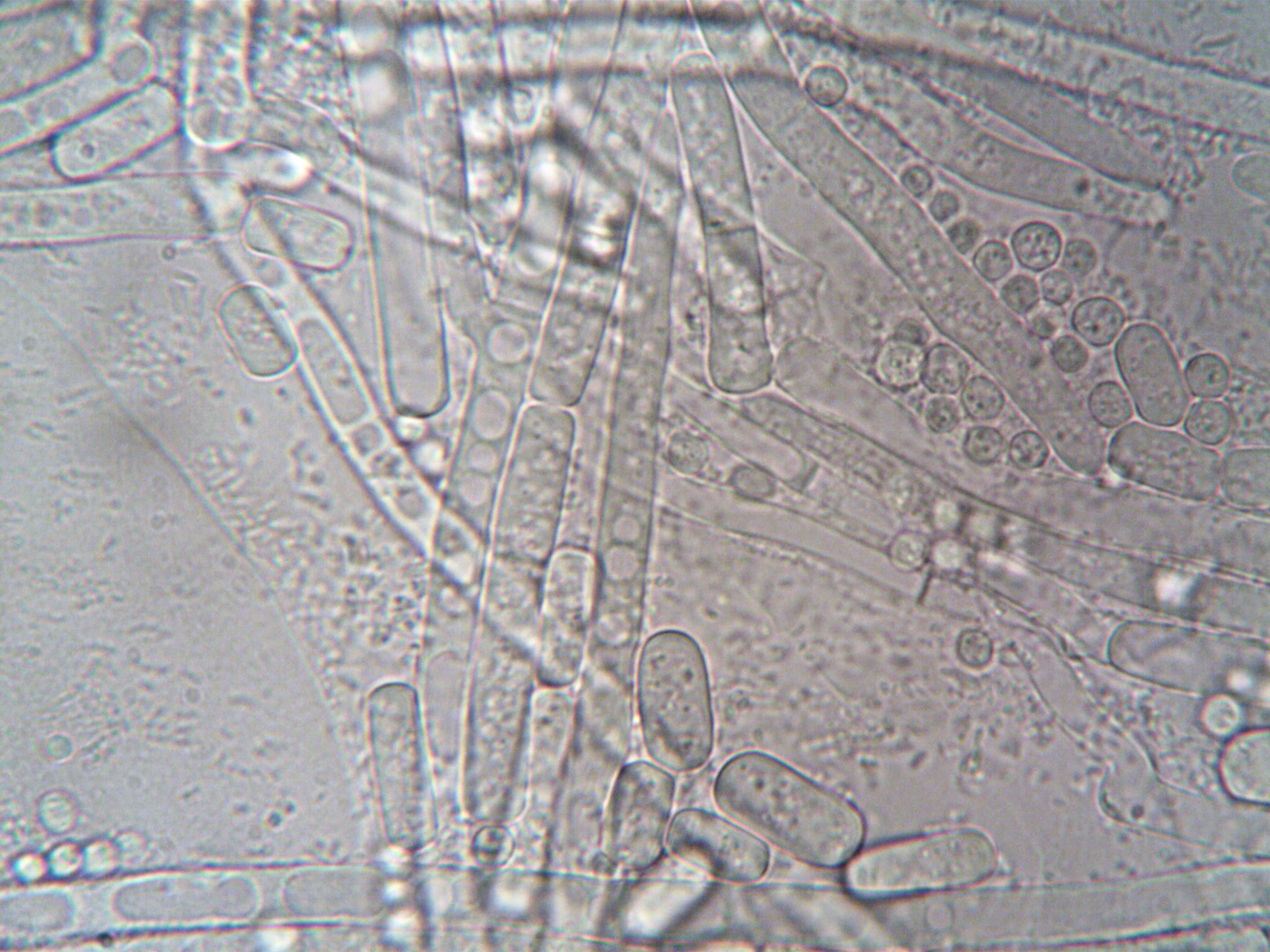 petri dish cellular growth