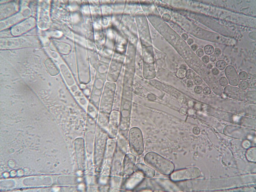 petri dish cellular growth
