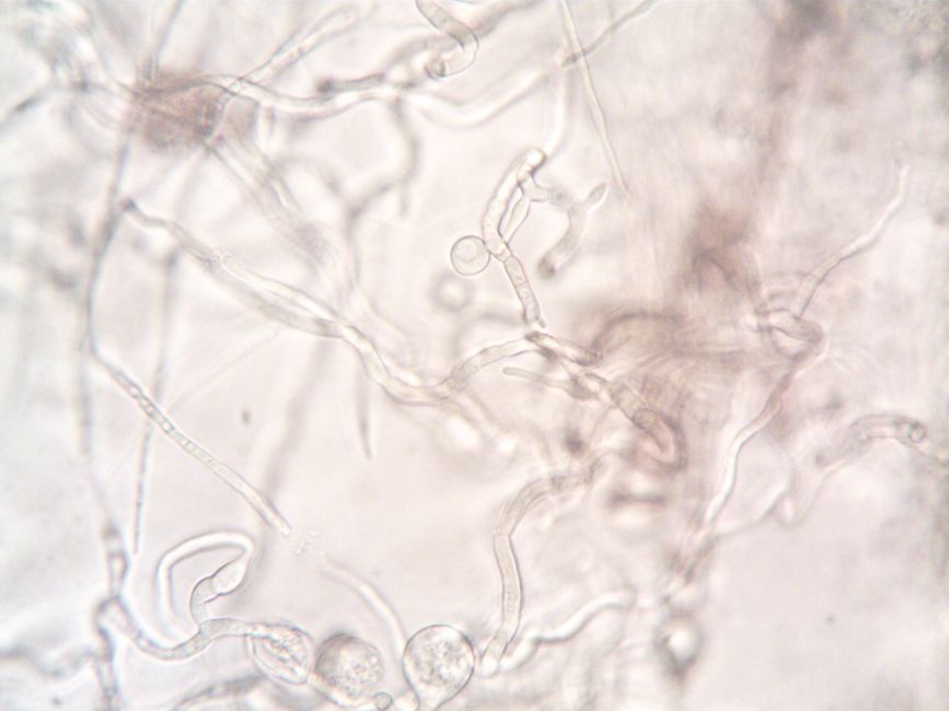 Picture for The quiet cells that shape our fear
