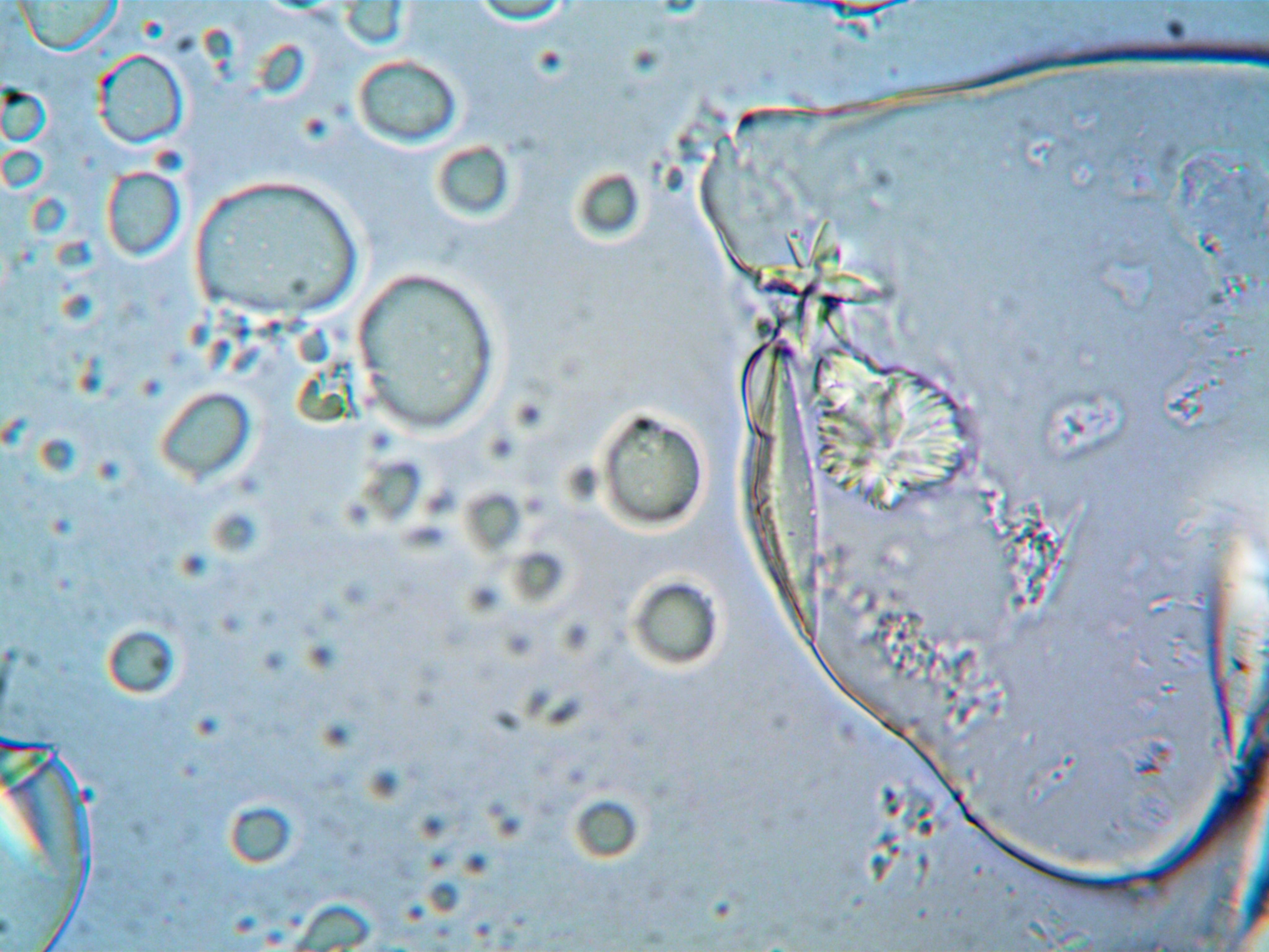 brain cells under microscope