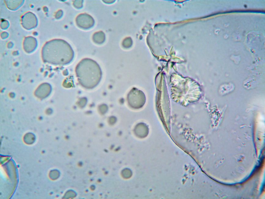 brain cells under microscope