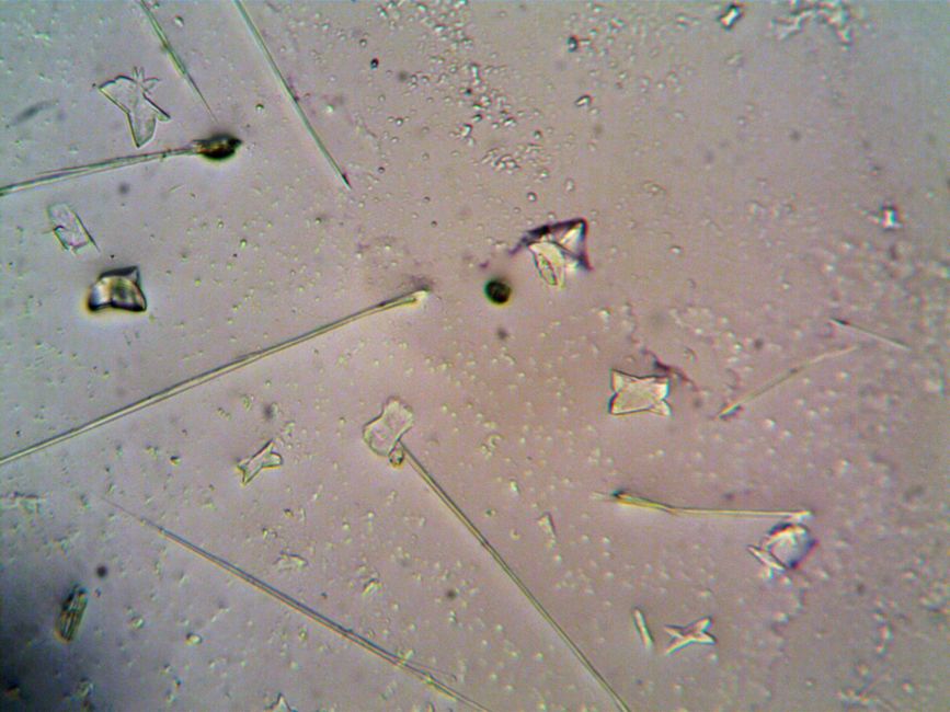 Picture for Scientists find immune cells may act as anxiety's hidden control system